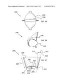 TRANSCATHETER MITRAL VALVE diagram and image