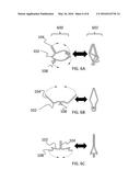 TRANSCATHETER MITRAL VALVE diagram and image