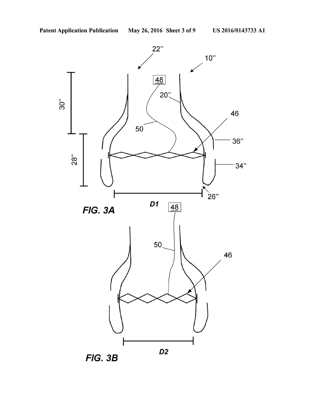 REPLACEMENT HEART VALVE AND METHOD - diagram, schematic, and image 04