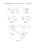 ADJUSTABLE IMPLANT SYSTEM diagram and image