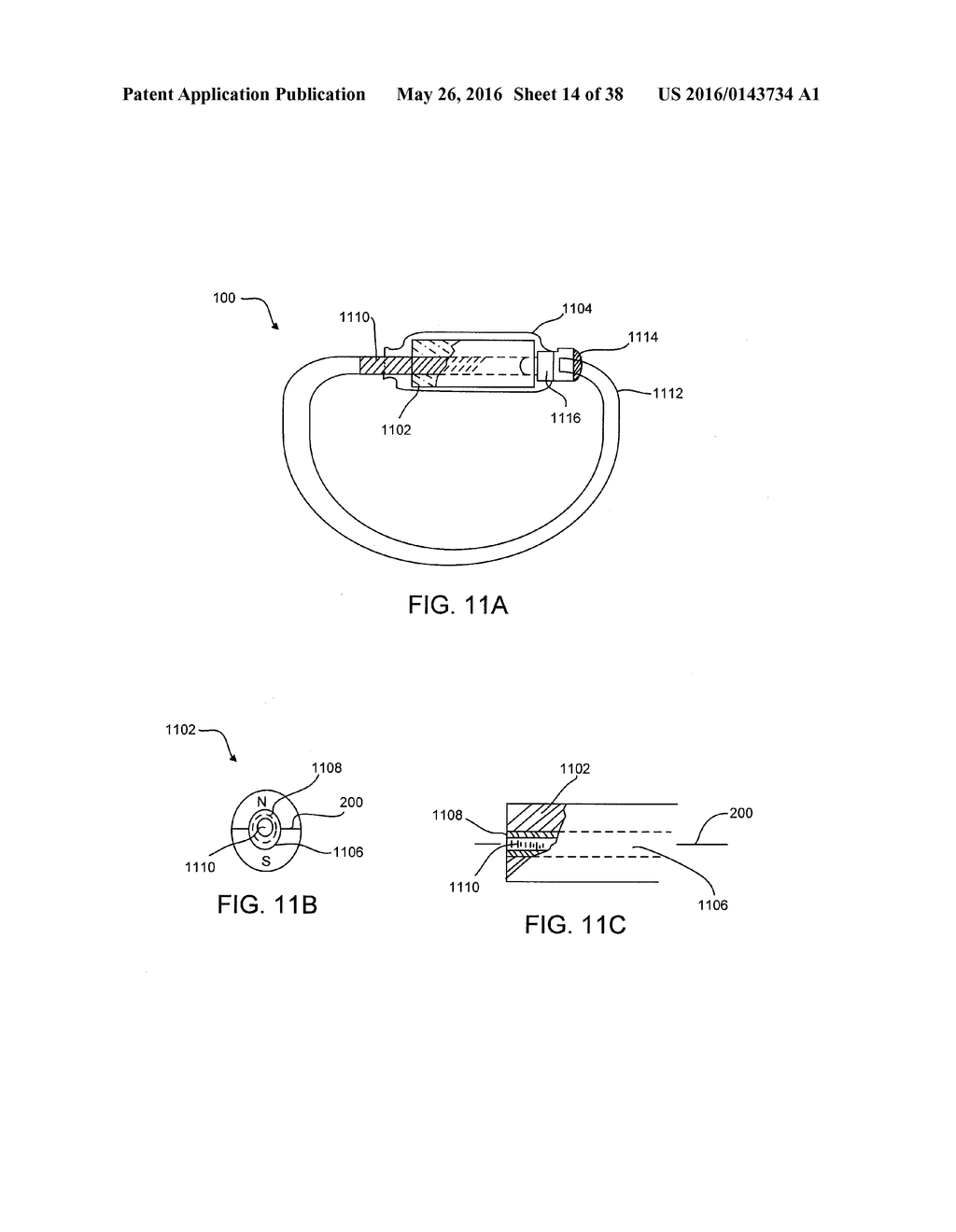 ADJUSTABLE IMPLANT SYSTEM - diagram, schematic, and image 15