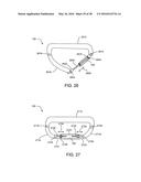 ADJUSTABLE IMPLANT SYSTEM diagram and image