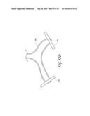 TRANSVALVULAR INTRAANNULAR BAND FOR VALVE REPAIR diagram and image