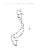 TRANSVALVULAR INTRAANNULAR BAND FOR VALVE REPAIR diagram and image