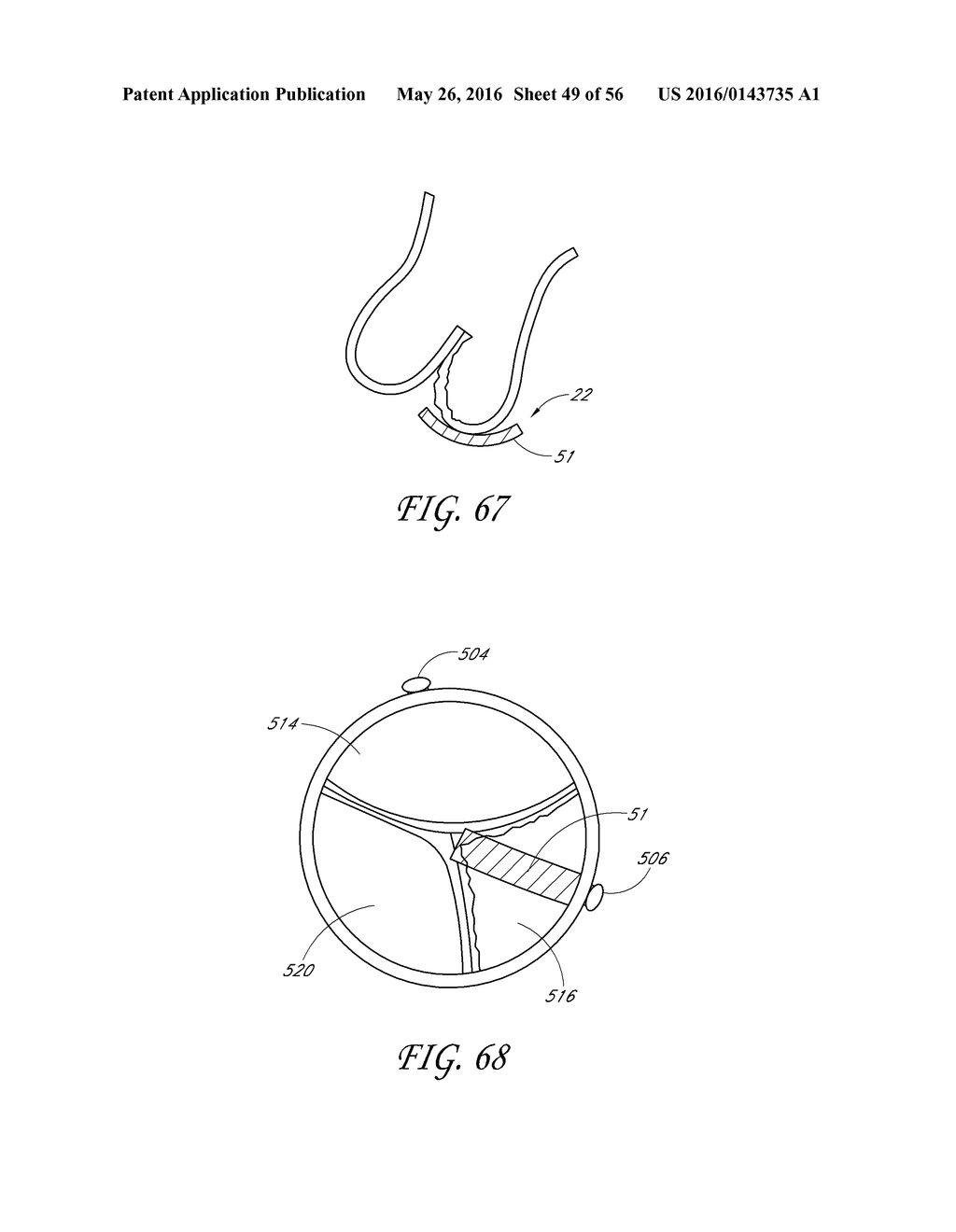 TRANSVALVULAR INTRAANNULAR BAND FOR VALVE REPAIR - diagram, schematic, and image 50