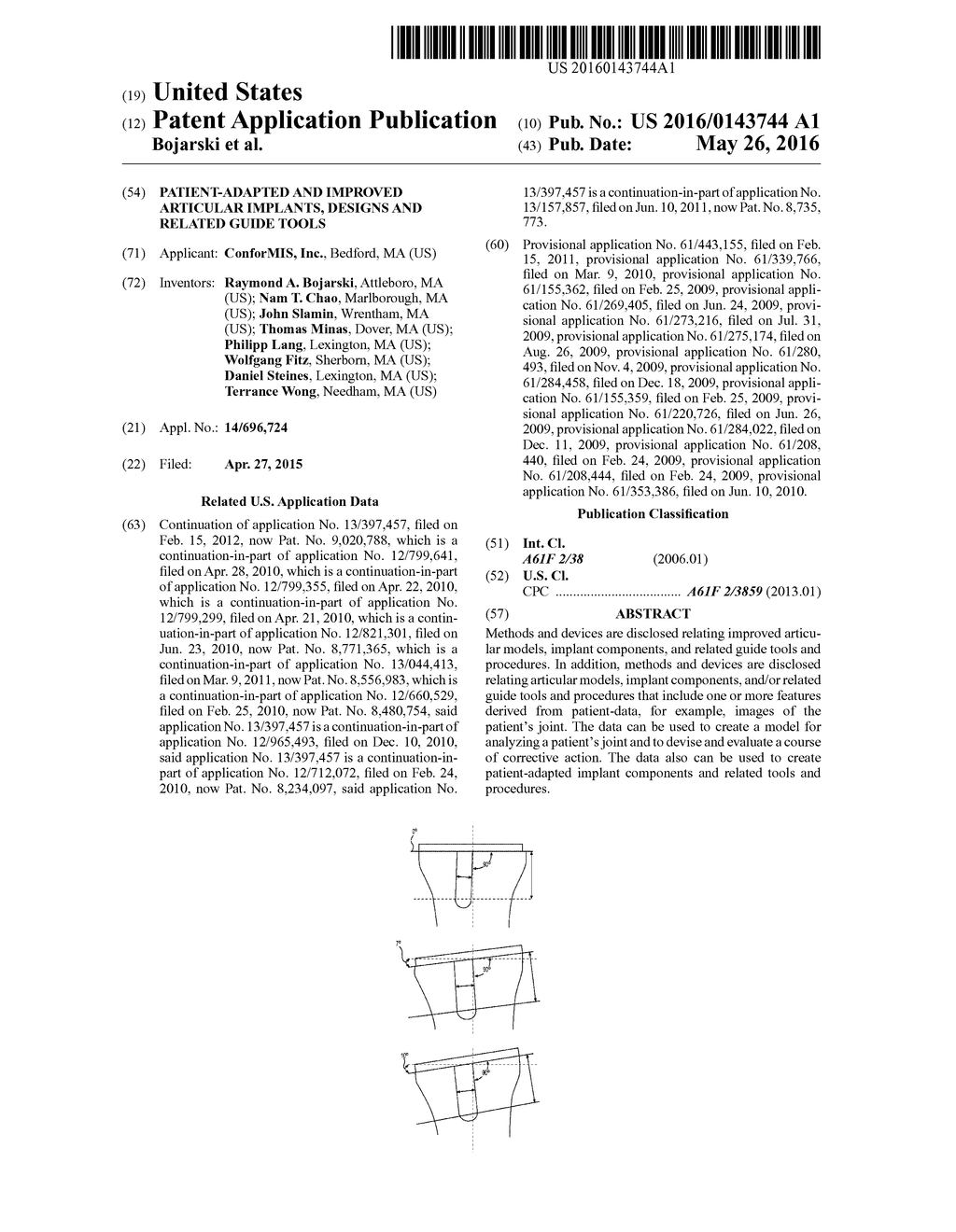 Patient-Adapted and Improved Articular Implants, Designs and Related Guide     Tools - diagram, schematic, and image 01