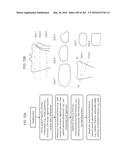 Patient-Adapted and Improved Articular Implants, Designs and Related Guide     Tools diagram and image