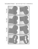 Patient-Adapted and Improved Articular Implants, Designs and Related Guide     Tools diagram and image