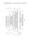 Patient-Adapted and Improved Articular Implants, Designs and Related Guide     Tools diagram and image