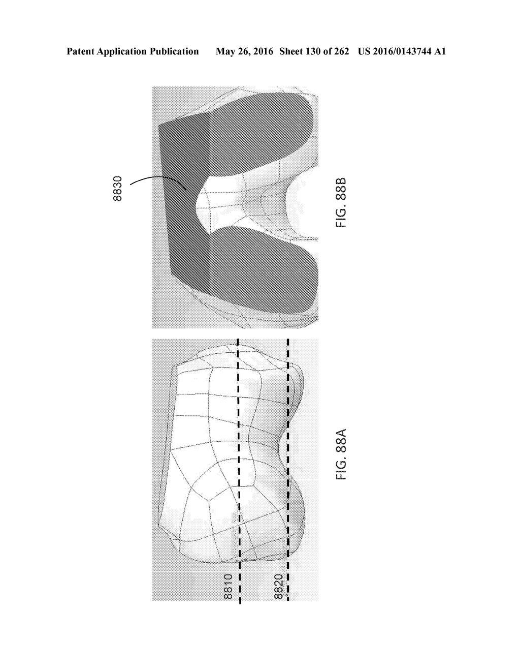 Patient-Adapted and Improved Articular Implants, Designs and Related Guide     Tools - diagram, schematic, and image 131