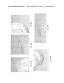 Patient-Adapted and Improved Articular Implants, Designs and Related Guide     Tools diagram and image