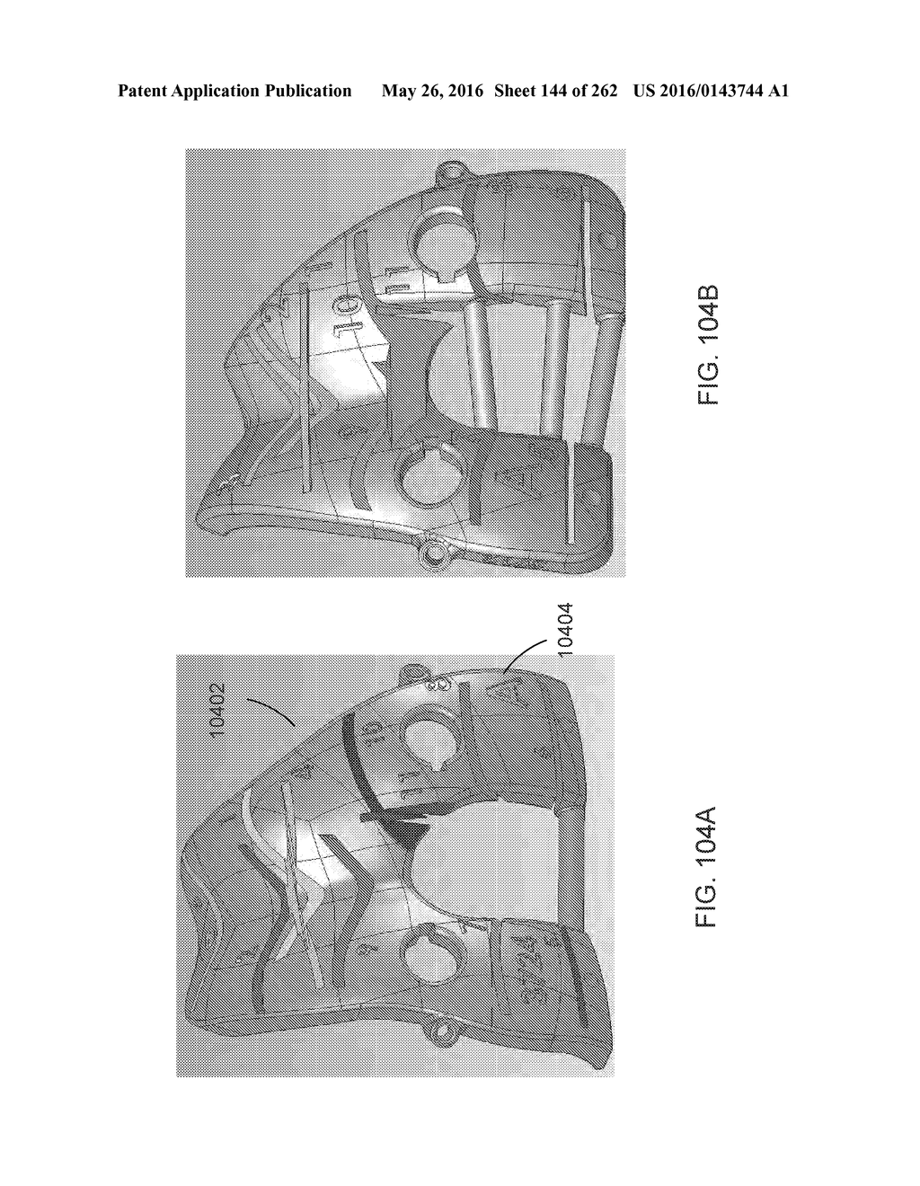 Patient-Adapted and Improved Articular Implants, Designs and Related Guide     Tools - diagram, schematic, and image 145