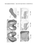 Patient-Adapted and Improved Articular Implants, Designs and Related Guide     Tools diagram and image