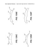 Patient-Adapted and Improved Articular Implants, Designs and Related Guide     Tools diagram and image