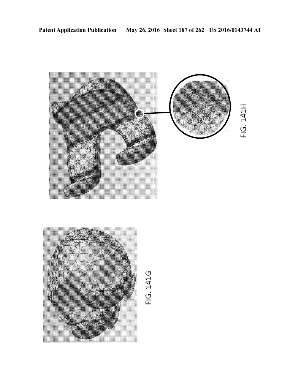 Patient-Adapted and Improved Articular Implants, Designs and Related Guide     Tools - diagram, schematic, and image 188