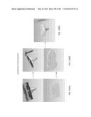 Patient-Adapted and Improved Articular Implants, Designs and Related Guide     Tools diagram and image