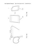 Patient-Adapted and Improved Articular Implants, Designs and Related Guide     Tools diagram and image