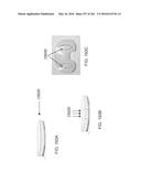 Patient-Adapted and Improved Articular Implants, Designs and Related Guide     Tools diagram and image