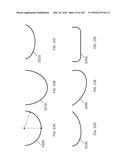 Patient-Adapted and Improved Articular Implants, Designs and Related Guide     Tools diagram and image