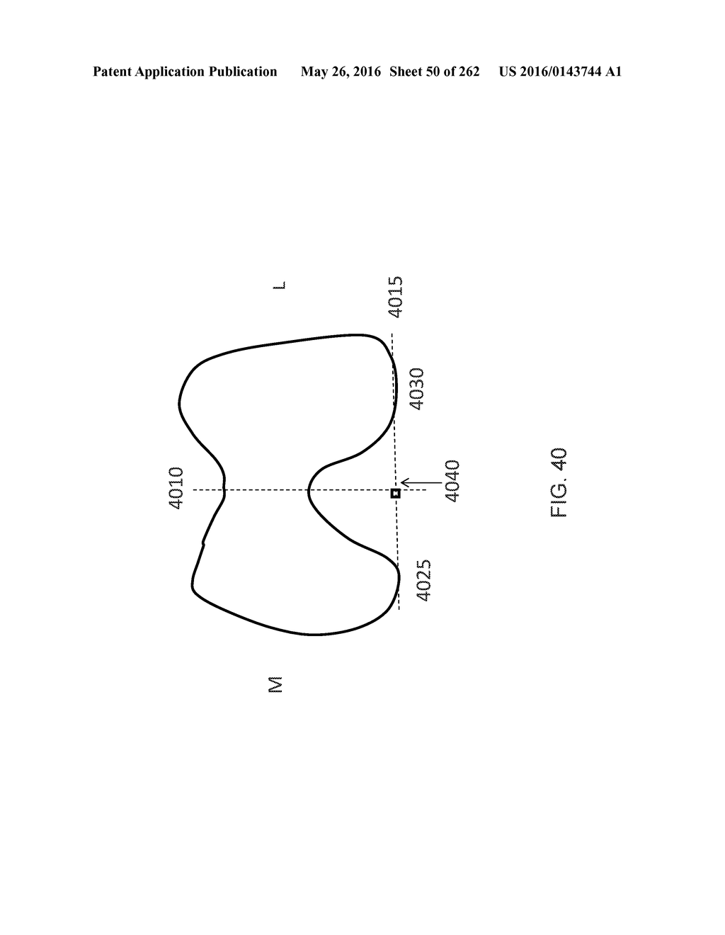 Patient-Adapted and Improved Articular Implants, Designs and Related Guide     Tools - diagram, schematic, and image 51