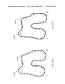 Patient-Adapted and Improved Articular Implants, Designs and Related Guide     Tools diagram and image