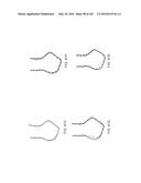 Patient-Adapted and Improved Articular Implants, Designs and Related Guide     Tools diagram and image