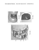 Patient-Adapted and Improved Articular Implants, Designs and Related Guide     Tools diagram and image