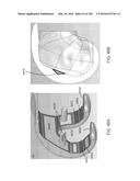 Patient-Adapted and Improved Articular Implants, Designs and Related Guide     Tools diagram and image