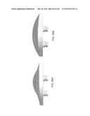 Patient-Adapted and Improved Articular Implants, Designs and Related Guide     Tools diagram and image