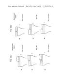 Patient-Adapted and Improved Articular Implants, Designs and Related Guide     Tools diagram and image