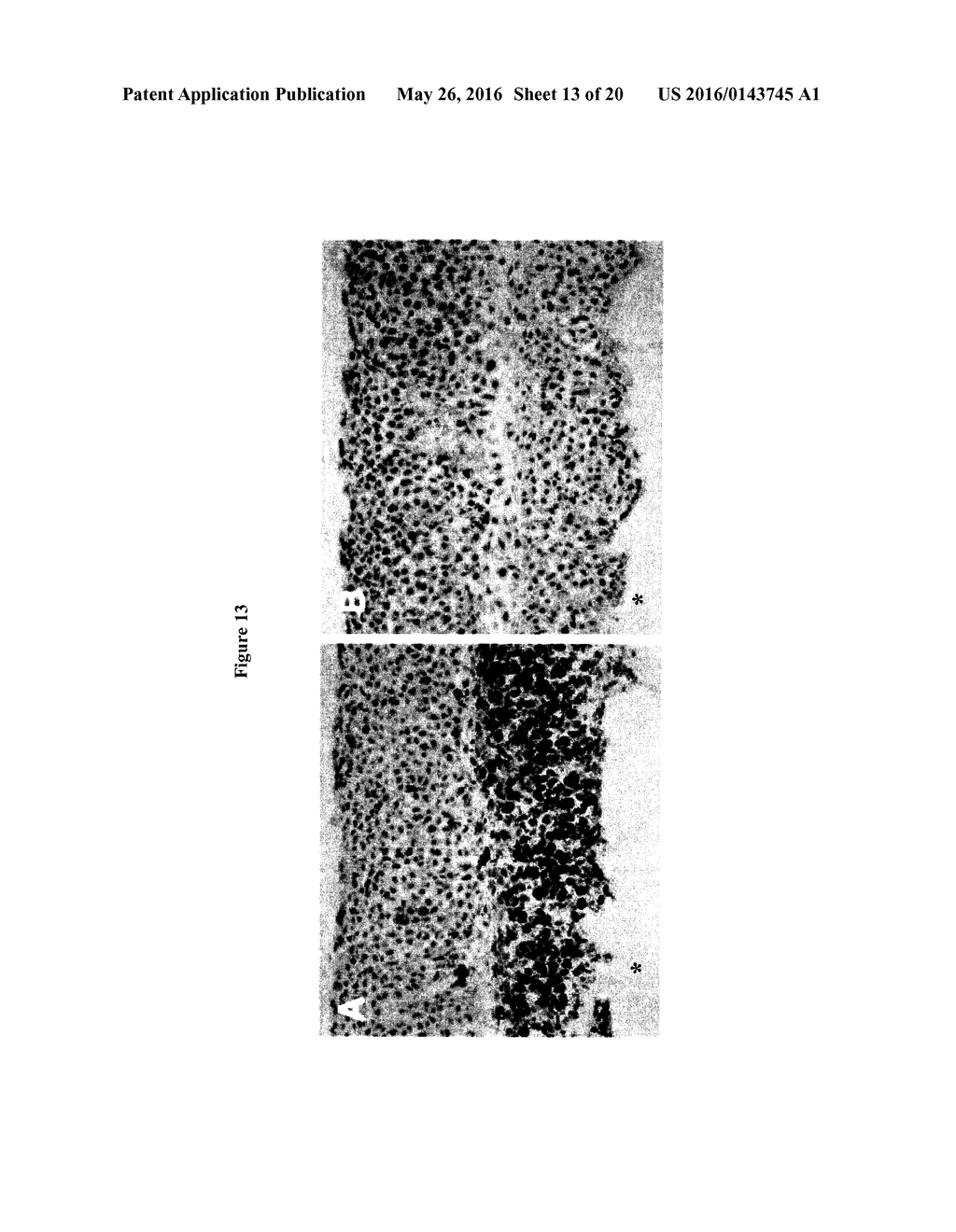 INTERVERTEBRAL DISC IMPLANT - diagram, schematic, and image 14