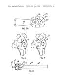 GLENOID COMPONENT INSTALLATION PROCEDURE AND TOOLING FOR SHOULDER     ARTHROPLASTY diagram and image