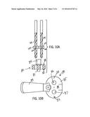 GLENOID COMPONENT INSTALLATION PROCEDURE AND TOOLING FOR SHOULDER     ARTHROPLASTY diagram and image