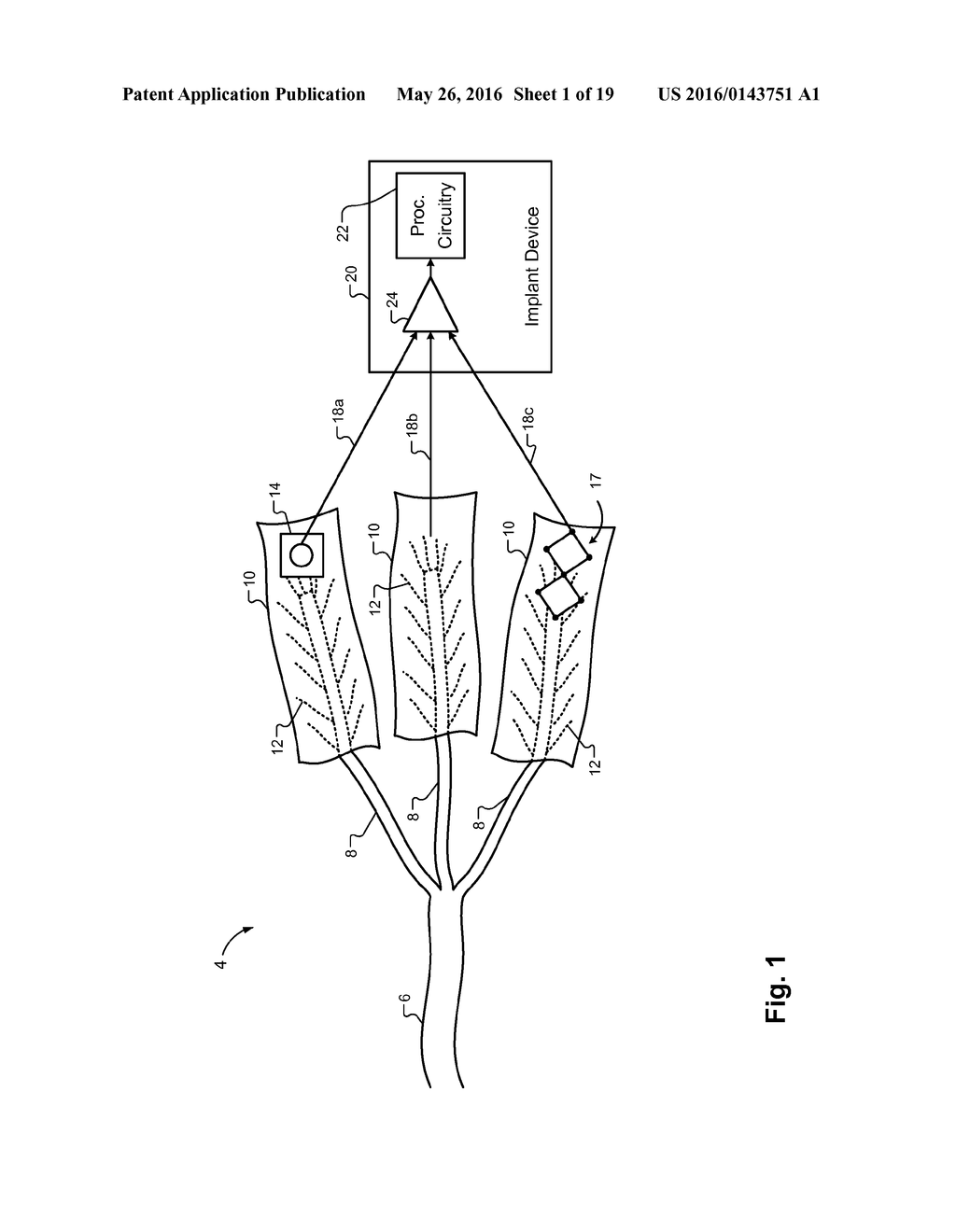 METHOD FOR AMPLIFYING SIGNALS FROM INDIVIDUAL NERVE FASCICLES - diagram, schematic, and image 02