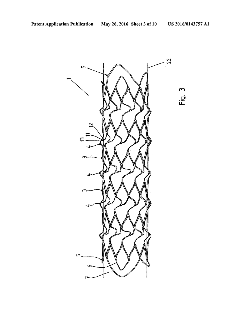 STENT - diagram, schematic, and image 04