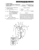 TRANSATRIAL PATIENT TEMPERATURE CONTROL CATHETER diagram and image