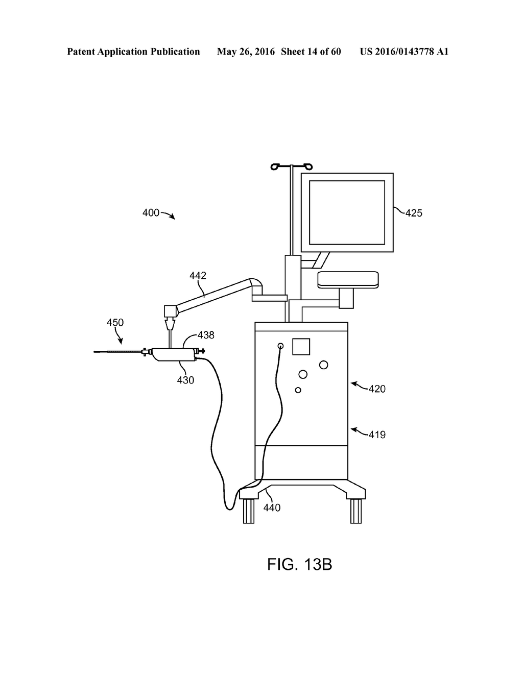 AQUABLATION AQUABEAM EYE SURGERY METHODS AND APPARATUS - diagram, schematic, and image 15