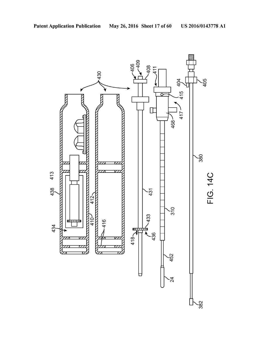 AQUABLATION AQUABEAM EYE SURGERY METHODS AND APPARATUS - diagram, schematic, and image 18