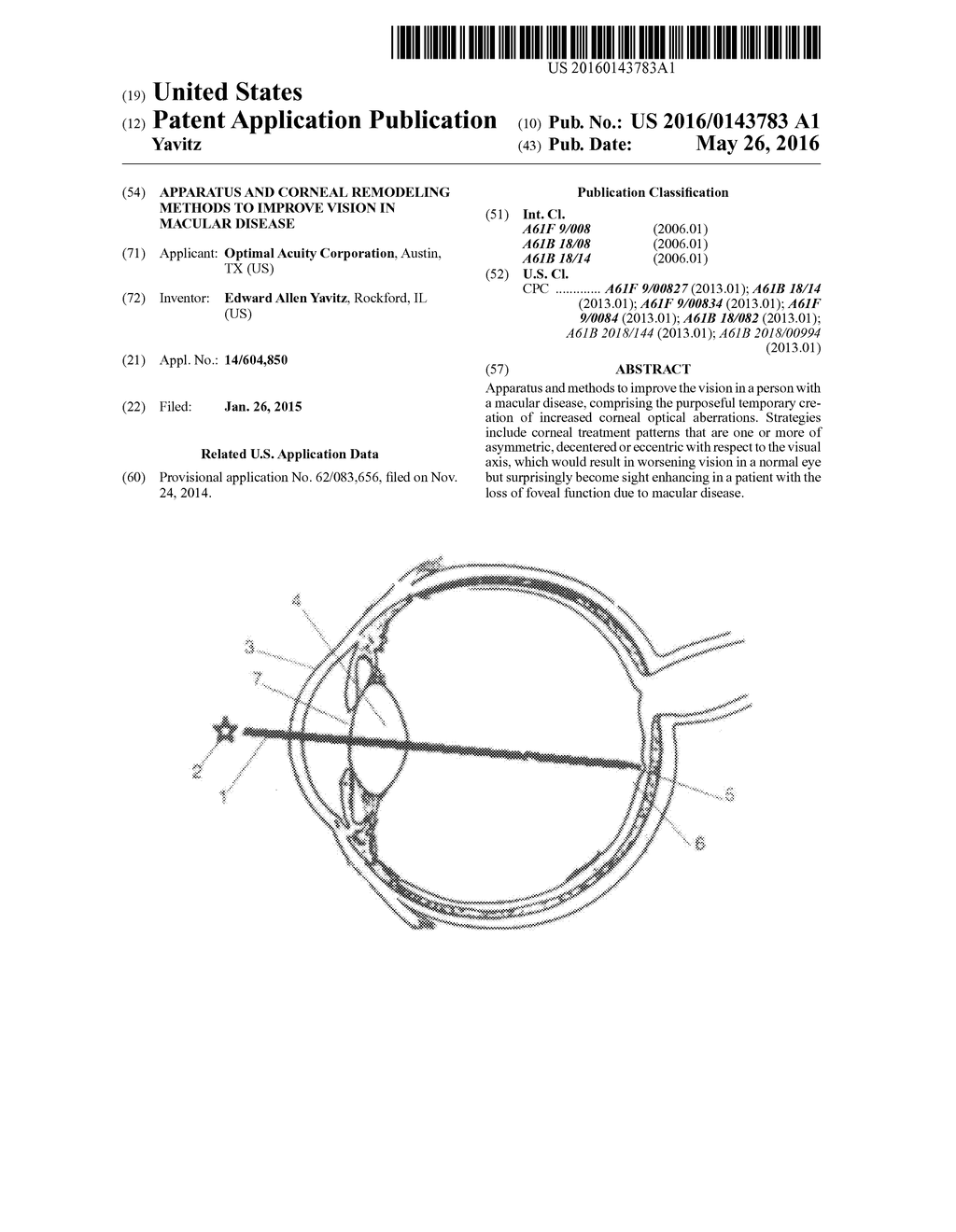 Apparatus and Corneal Remodeling Methods to Improve Vision in Macular     Disease - diagram, schematic, and image 01