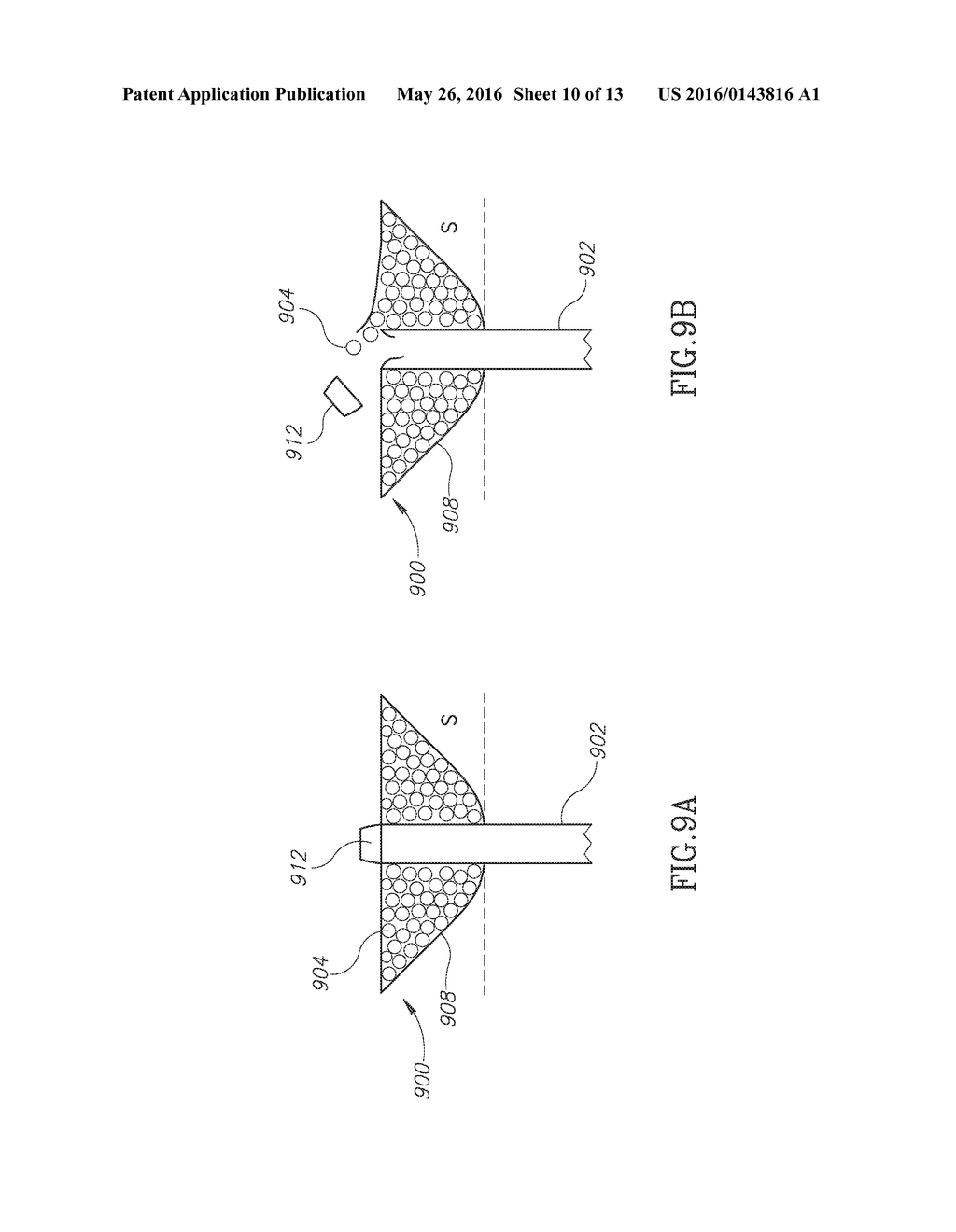 DEVICES AND METHODS FOR PERCUTANEOUS ENDOSCOPIC GASTROSTOMY AND OTHER     OSTOMY PROCEDURES - diagram, schematic, and image 11