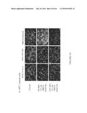 COMPOSITIONS AND THEIR USE FOR REMOVING CHOLESTEROL diagram and image