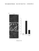 COMPOSITIONS AND THEIR USE FOR REMOVING CHOLESTEROL diagram and image