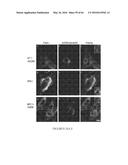 COMPOSITIONS AND THEIR USE FOR REMOVING CHOLESTEROL diagram and image