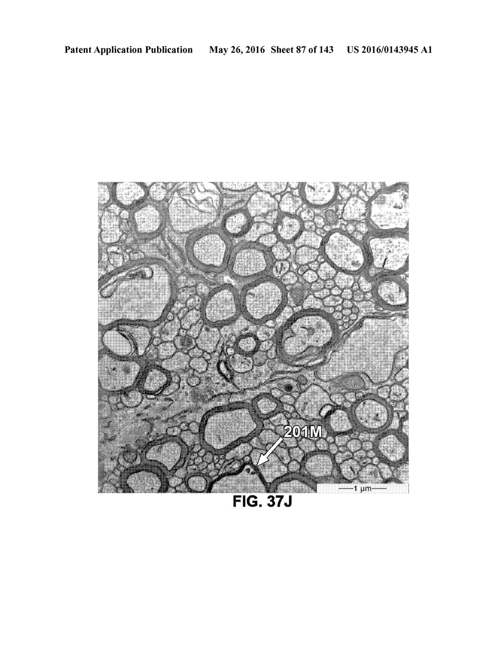 Methods and Treatment for Certain Demyelination and Dysmyelination-Based     Disorders and/or Promoting Remyelination - diagram, schematic, and image 88