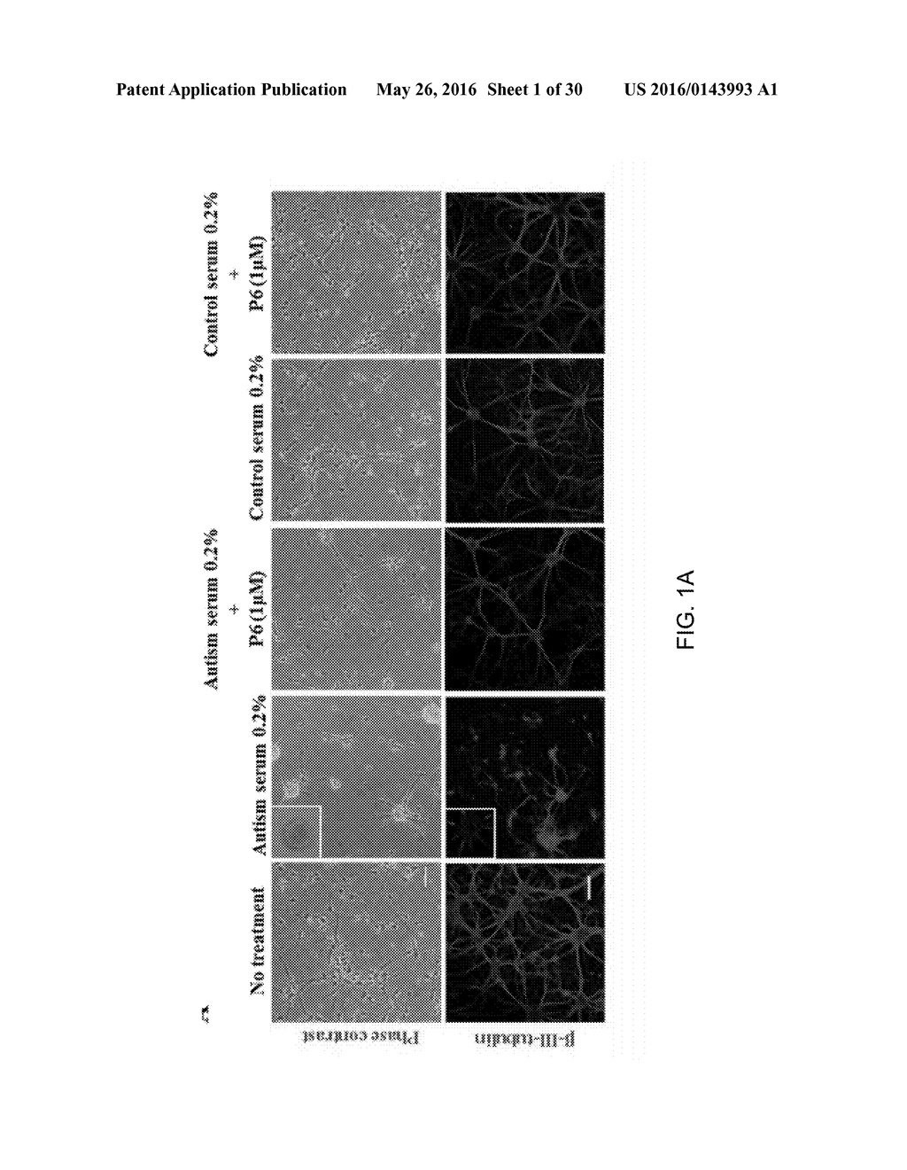 TREATMENT OF AUTISM SPECTRUM DISORDERS WITH CILIARY NEUROTROPHIC FACTOR     PEPTIDE MIMETIC - diagram, schematic, and image 02