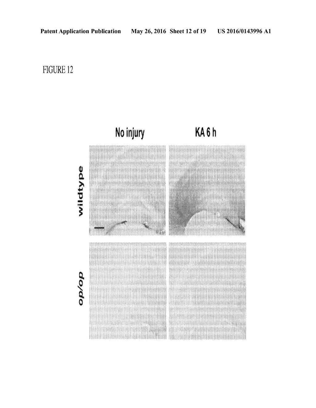 METHODS OF NEUROPROTECTION INVOLVING MACROPHAGE COLONY STIMULATING FACTOR     RECEPTOR AGONISTS - diagram, schematic, and image 13