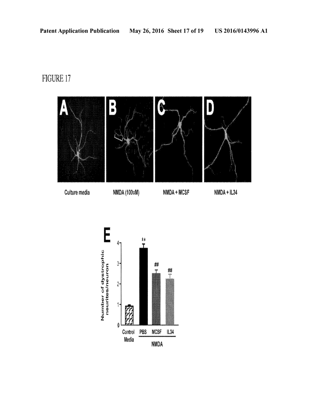 METHODS OF NEUROPROTECTION INVOLVING MACROPHAGE COLONY STIMULATING FACTOR     RECEPTOR AGONISTS - diagram, schematic, and image 18