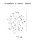 Biological Constructs for Treating Damaged Organs and Tissue diagram and image