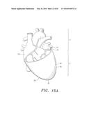 Biological Constructs for Treating Damaged Organs and Tissue diagram and image