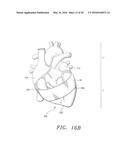 Biological Constructs for Treating Damaged Organs and Tissue diagram and image